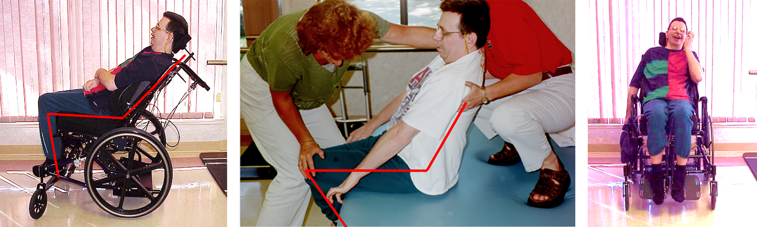 Wheelchair Contracture Footplate Client gets help from his carer.